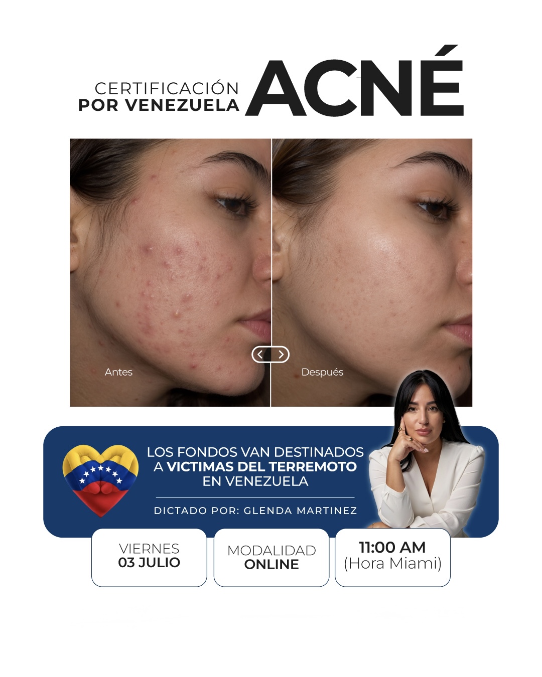 Certificación de Acné por Venezuela — dictado por Glenda Martínez. Viernes 03 de julio, Online, 11:00 AM hora Miami. Los fondos van destinados a víctimas del terremoto en Venezuela.